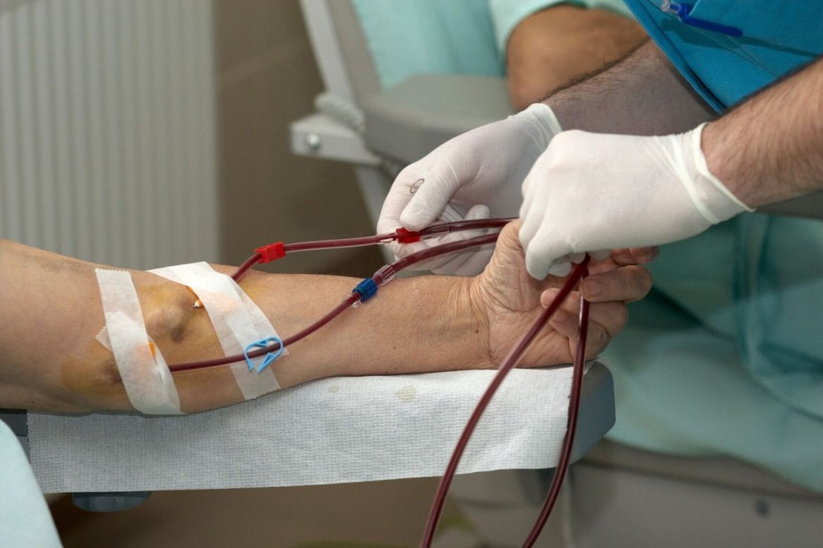 Patient undergoing hemodialysis patient