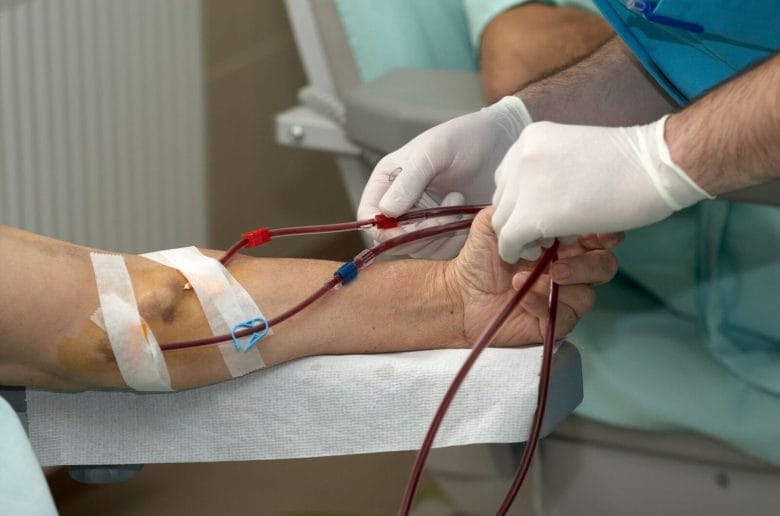 Patient undergoing hemodialysis patient